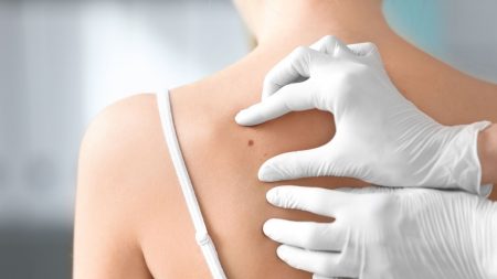 Dermatoložka radí: Účinné postupy pro prevenci rakoviny kůže